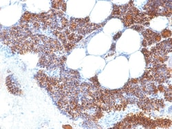 Parathyroid Hormone Mouse, Clone: SPM604, enQuireBio 100 &mu;g | Buy Online | EnquireBio | Fisher Scientific