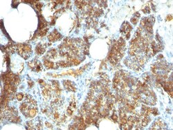 Parathyroid Hormone Mouse, Clone: PTH/1173, enQuireBio 100 &mu;g:Antibodies,