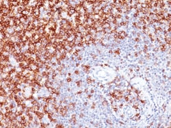 CD45RO Mouse, Clone: UCHL-1, enQuireBio 100 &mu;g:Antibodies, Monoclonal