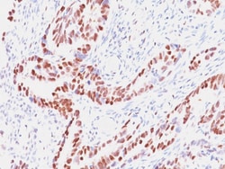 Rb1 Mouse, Clone: SPM353, enQuireBio 100 &mu;g:Antibodies, Monoclonal