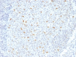 Bcl-6 Mouse, Clone: BCL6/1526, enQuireBio:Antibodies:Primary Antibodies