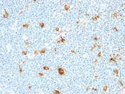 Calgranulin B Mouse, Clone: CAGB/426, enQuireBio 100 &mu;g:Antibodies,