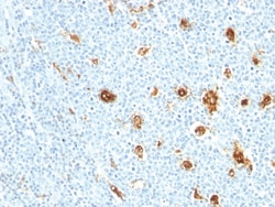 Myeloid-Related Proteins 14 Mouse, Clone: MRP14/840, enQuireBio 100 &mu;g | Buy Online | EnquireBio | Fisher Scientific