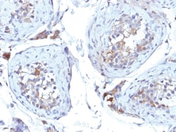 Sex Hormone Binding Globulin Mouse, Clone: SHBG/245, enQuireBio 100 &mu;g:Antibodies,