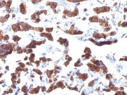 Thyroglobulin Mouse, Clone: TGB24, enQuireBio 100 &mu;g:Anticuerpos