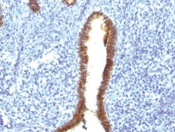 ASRGL1 Mouse, Clone: CRASH/1289, enQuireBio:Antibodies:Primary Antibodies