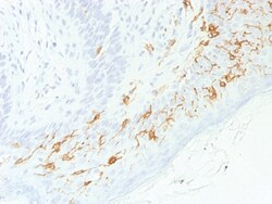 CD1a / HTA1 Rabbit, Clone: C1A/1506R, enQuireBio 100 &mu;g:Antibodies,