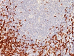 CD5 Mouse, Clone: C5/473, enQuireBio 100 &mu;g:Antibodies, Monoclonal