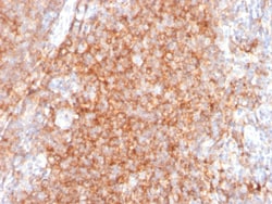 CD40 / TNFRSF5 / CD40L-Receptor Mouse, Clone: C40/2383, enQuireBio&trade; 100 &mu;g 