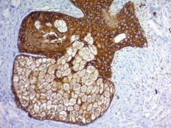 Cytokeratin Mouse, Clone: PAN-CK (Cocktail), enQuireBio 100 &mu;g:Antikörper