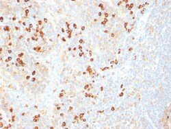 Plasma Cell Marker Mouse, Clone: SPM310, enQuireBio 100 &mu;g:Antibodies,