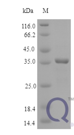 enQuireBio Recombinant Human Osteonectin / SPARC Protein 10 &mu;g | Buy Online | enQuireBio&trade; | Fisher Scientific