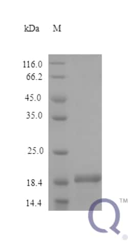 enQuireBio Recombinant Human IHH Protein 5 &mu;g | Buy Online | enQuireBio&trade; | Fisher Scientific