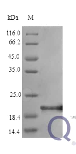 enQuireBio Recombinant Human IL6 / Interleukin-6 Protein 100 &mu;g | Buy Online | enQuireBio&trade; | Fisher Scientific