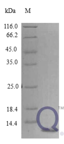 enQuireBio Recombinant Human Epigen Protein 5 &mu;g | Buy Online | enQuireBio&trade; | Fisher Scientific