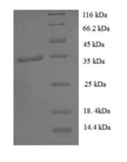 enQuireBio Recombinant Human General transcription factor IIH subunit 5 Protein 10 &mu;g | Buy Online | enQuireBio&trade; | Fisher Scientific