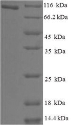 enQuireBio Recombinant Human Holliday junction recognition Protein 50 &mu;g | Buy Online | enQuireBio&trade; | Fisher Scientific