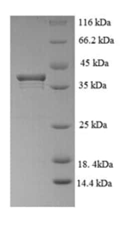 enQuireBio Recombinant Human KIAA0101 / p15 / PAF Protein 10 &mu;g | Buy Online | enQuireBio&trade; | Fisher Scientific