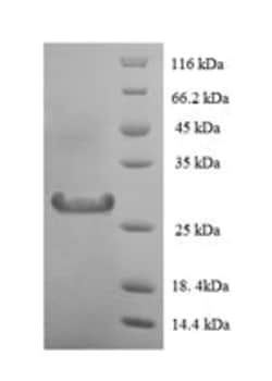 enQuireBio Recombinant Human Lysozyme C Protein 10 &mu;g | Buy Online | enQuireBio&trade; | Fisher Scientific