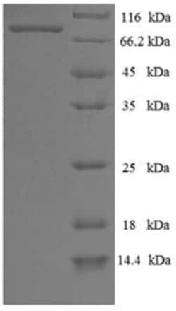 enQuireBio Recombinant Influenza B (strain B / Lee / 1940) NucleoProtein 10 &mu;g | Buy Online | enQuireBio&trade; | Fisher Scientific