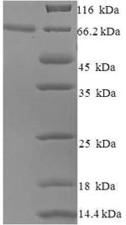 enQuireBio Recombinant Human Minor capsid protein L2 Protein 10 &mu;g | Buy Online | enQuireBio&trade; | Fisher Scientific