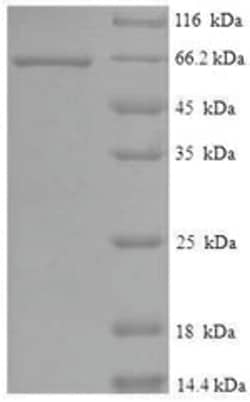 enQuireBio Recombinant Human Serine / threonine-protein kinase STK11 Protein 1 mg | Buy Online | enQuireBio&trade; | Fisher Scientific