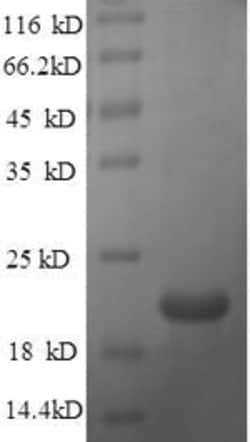 enQuireBio Recombinant Mouse Beta-defensin 14 Protein 1 mg | Buy Online | enQuireBio&trade; | Fisher Scientific