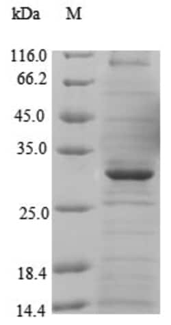 enQuireBio Recombinant Human MFSD8 Protein 10 &mu;g | Buy Online | enQuireBio&trade; | Fisher Scientific