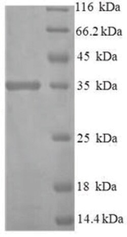 enQuireBio Recombinant Human Protein disulfide-isomerase TMX3 Protein 50 &mu;g | Buy Online | enQuireBio&trade; | Fisher Scientific