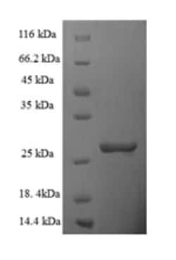 enQuireBio Recombinant Human TIMM10B Protein 1 mg | Buy Online | enQuireBio&trade; | Fisher Scientific