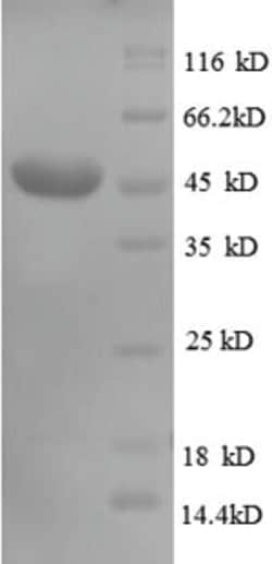 enQuireBio Recombinant Human CD320 Protein 10 &mu;g | Buy Online | enQuireBio&trade; | Fisher Scientific