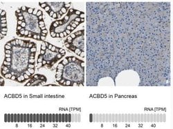 ACBD5 Antibody, Novus Biologicals:Antibodies:Primary Antibodies