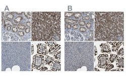 ACBD5 Antibody, Novus Biologicals:Antibodies:Primary Antibodies