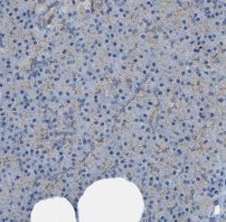 ACBD5 Antibody, Novus Biologicals:Antibodies:Primary Antibodies