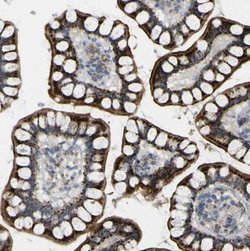 ACBD5 Antibody, Novus Biologicals:Antibodies:Primary Antibodies