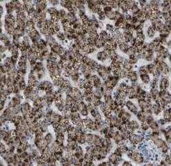 ACBD5 Antibody, Novus Biologicals:Antibodies:Primary Antibodies