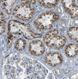 ACBD5 Antibody, Novus Biologicals:Antibodies:Primary Antibodies
