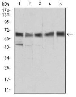 ALDH6A1 Antibody (6H9B8) - BSA Free, Novus Biologicals 0.1mg; Unlabeled:Antibodies,