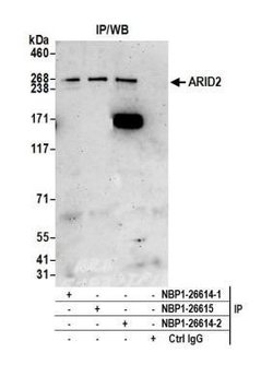 ARID2 Antibody, Novus Biologicals 0.1mg; Unlabeled:Antibodies, Polyclonal