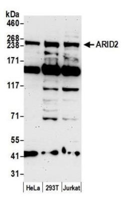 ARID2 Antibody, Novus Biologicals 0.1mg; Unlabeled:Antibodies, Polyclonal