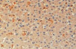 ASC/TMS1 Antibody, Novus Biologicals 0.10 miligramo | Buy Online | Novus Biologicals | Fisher Scientific