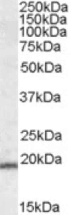 ASC/TMS1 Antibody, Novus Biologicals 0.10 miligramo | Buy Online | Novus Biologicals | Fisher Scientific