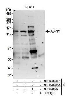 ASPP1 Antibody, Novus Biologicals 0.1mg; Unlabeled:Antibodies, Polyclonal
