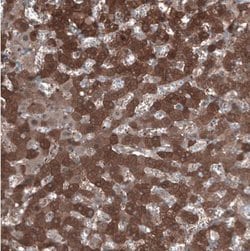 Aldehyde Dehydrogenase 1-A1/ALDH1A1 Antibody, Novus Biologicals:Antibodies:Primary