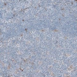 Aldehyde Dehydrogenase 1-A1/ALDH1A1 Antibody, Novus Biologicals:Antibodies:Primary