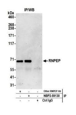 Aminopeptidase B/RNPEP Rabbit anti-Human, Polyclonal, Novus Biologicals