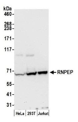 Aminopeptidase B/RNPEP Rabbit anti-Human, Polyclonal, Novus Biologicals