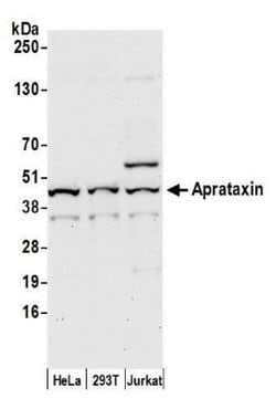 Aprataxin Antibody, Novus Biologicals 0.1mL; Unlabeled:Antibodies, Polyclonal