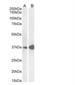 Arginase 1/ARG1/liver Arginase Antibody, Novus Biologicals 0.1mg; Unlabeled:Antibodies,