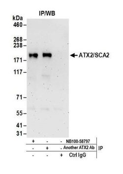 Ataxin-2 Antibody, Novus Biologicals 0.1mL; Unlabeled:Antibodies